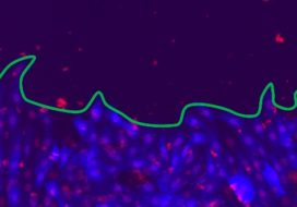 A physics perspective on wound healing